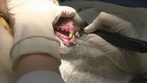 歯石処置中